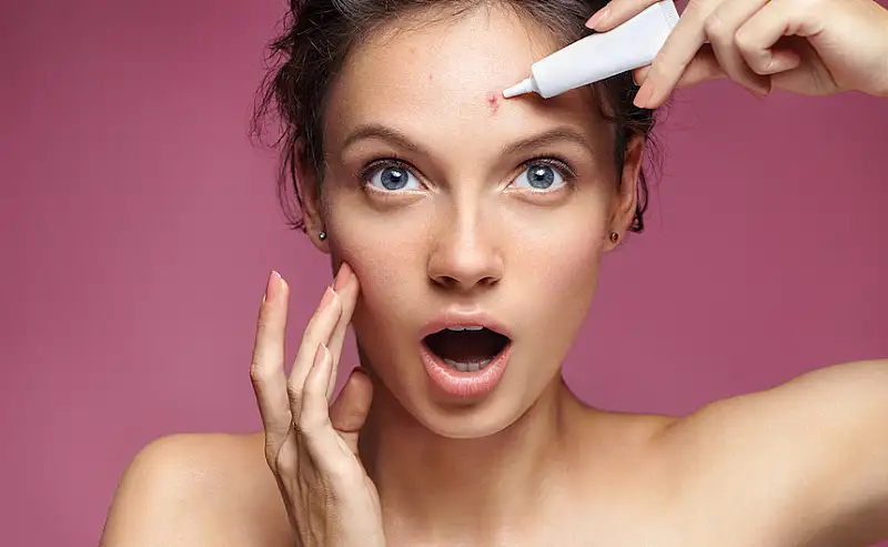 Acne Treatment